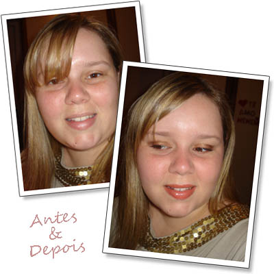 antesdepois